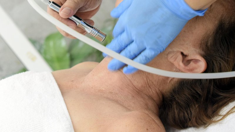 dermoklinika - mezoterapia 2.jpg