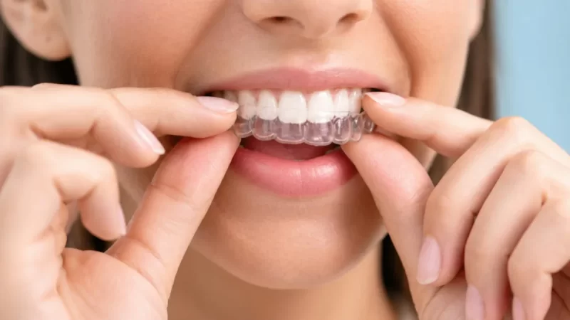 piotrowscybejnarowicz.pl - 006-kto-powinien-rozwazyc-aparat-invisalign-w-gliwicach-zalety-i.webp